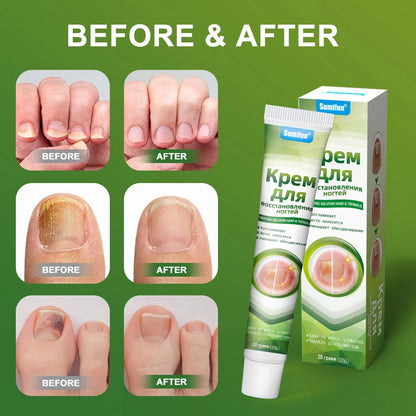 Sumifun - Nail Treatment Repair Gel (Original)